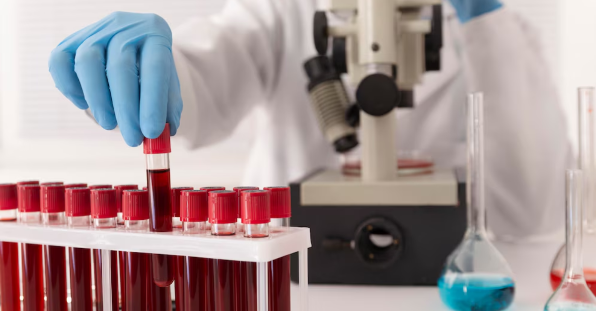The Future of Healthcare: Blood Tests You Can Take